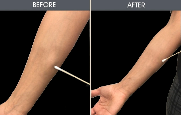 Real patient results in New York, NY Performed by Darrick E. Antell MD, FACS