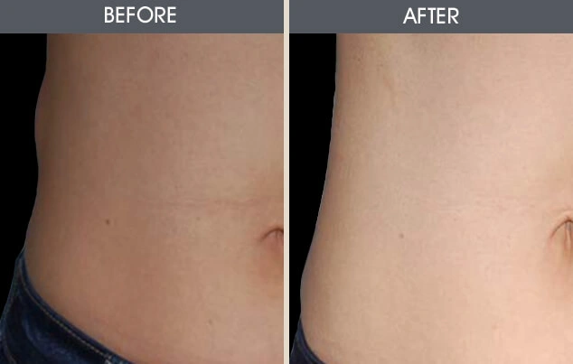 Real patient results in New York, NY Performed by Darrick E. Antell MD, FACS