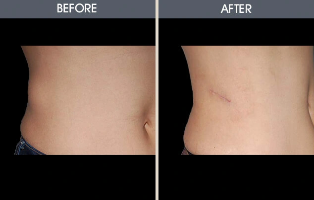 Real patient results in New York, NY Performed by Darrick E. Antell MD, FACS