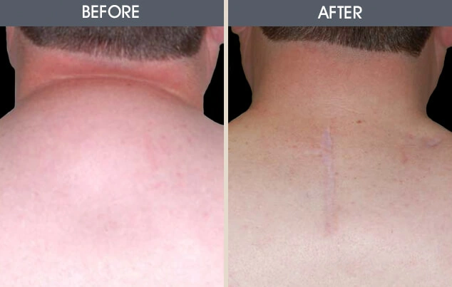 Real patient results in New York, NY Performed by Darrick E. Antell MD, FACS
