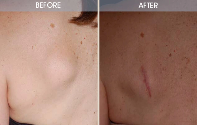 Real patient results in New York, NY Performed by Darrick E. Antell MD, FACS