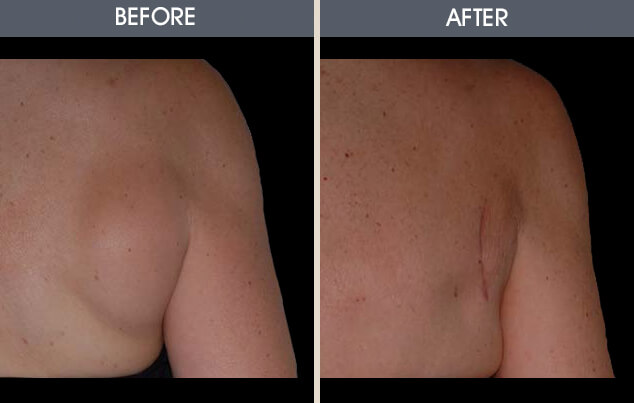 Real patient results in New York, NY Performed by Darrick E. Antell MD, FACS