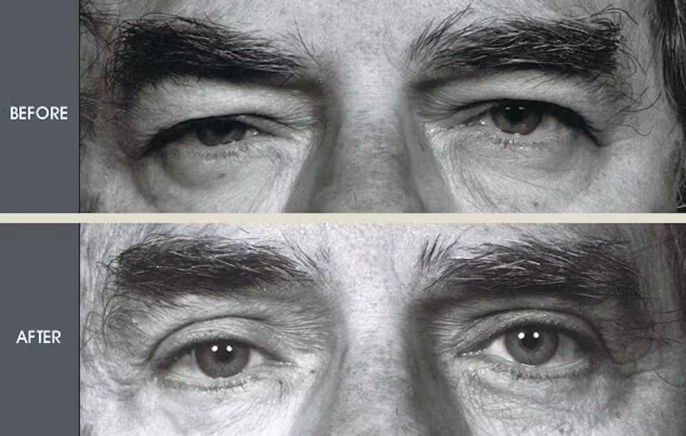 Real patient results in New York, NY Performed by Darrick E. Antell MD, FACS