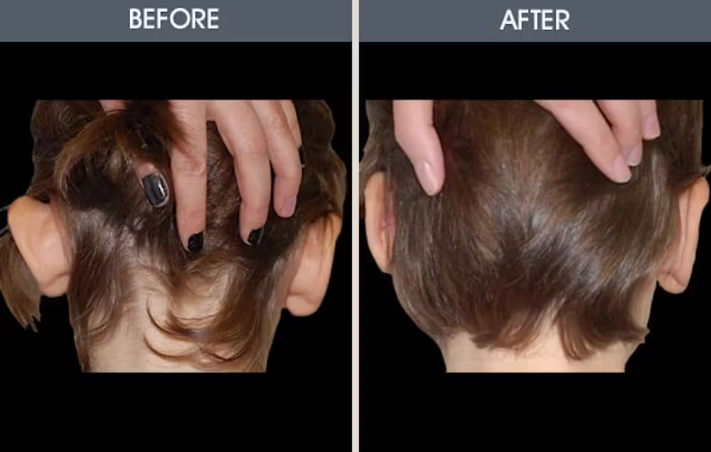 Real patient results in New York, NY Performed by Darrick E. Antell MD, FACS