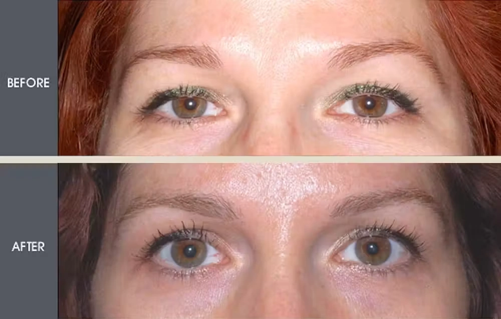 Real patient results in New York, NY Performed by Darrick E. Antell MD, FACS