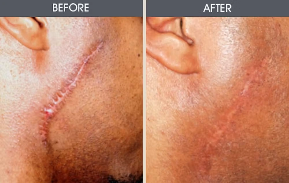Real patient results in New York, NY Performed by Darrick E. Antell MD, FACS