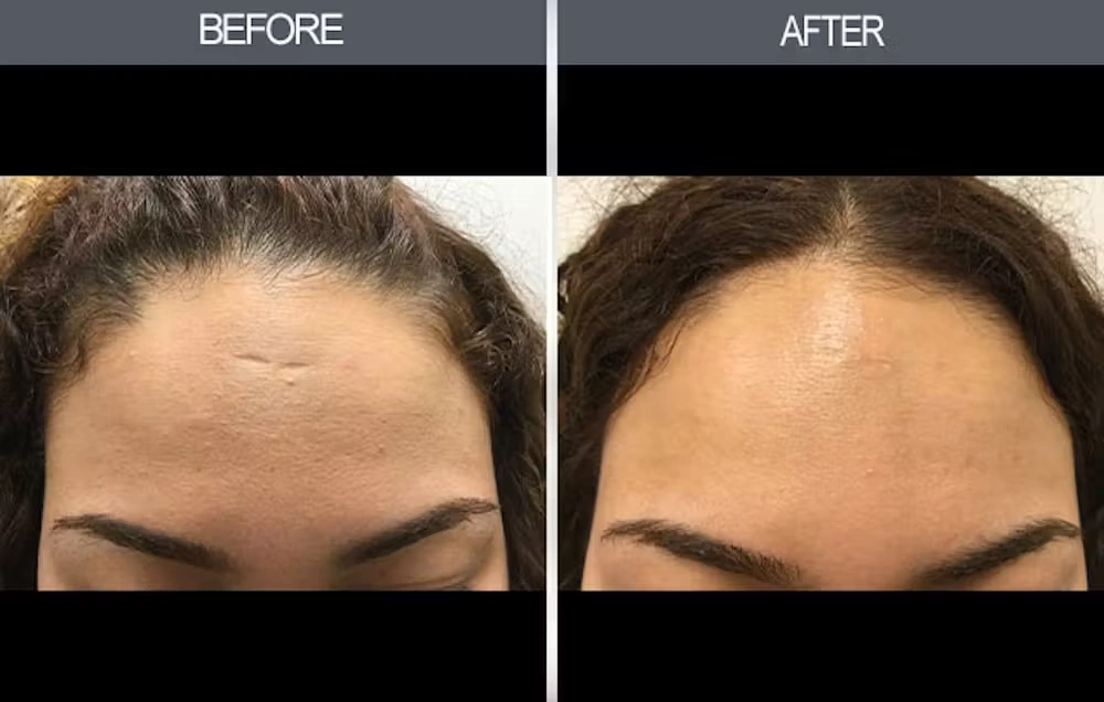 Real patient results in New York, NY Performed by Darrick E. Antell MD, FACS