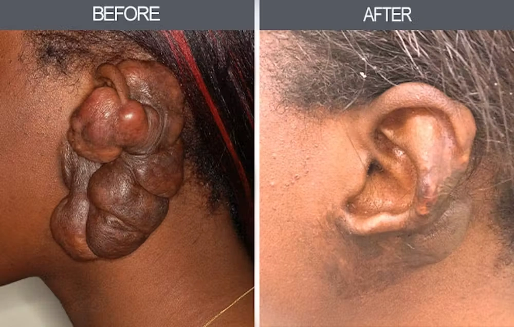 Real patient results in New York, NY Performed by Darrick E. Antell MD, FACS