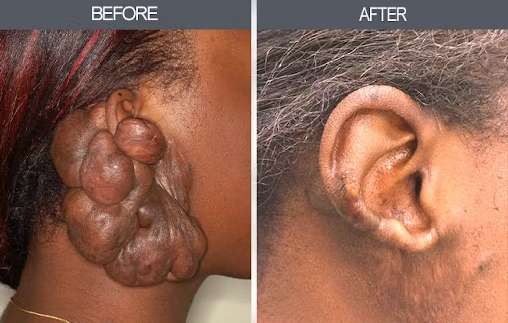 Real patient results in New York, NY Performed by Darrick E. Antell MD, FACS