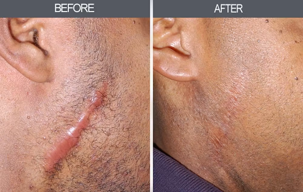 Real patient results in New York, NY Performed by Darrick E. Antell MD, FACS