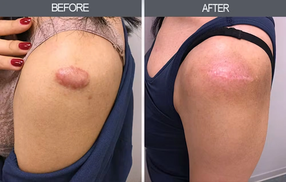 Real patient results in New York, NY Performed by Darrick E. Antell MD, FACS