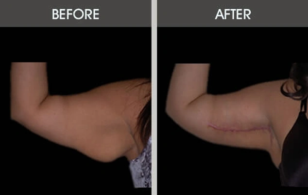 Real patient results in New York, NY Performed by Darrick E. Antell MD, FACS