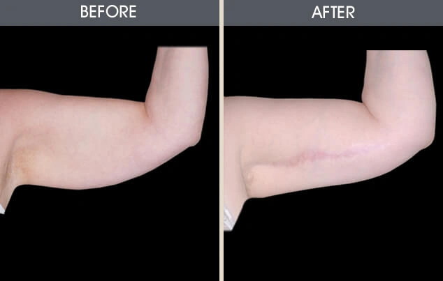 Real patient results in New York, NY Performed by Darrick E. Antell MD, FACS