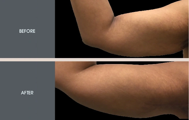 Real patient results in New York, NY Performed by Darrick E. Antell MD, FACS